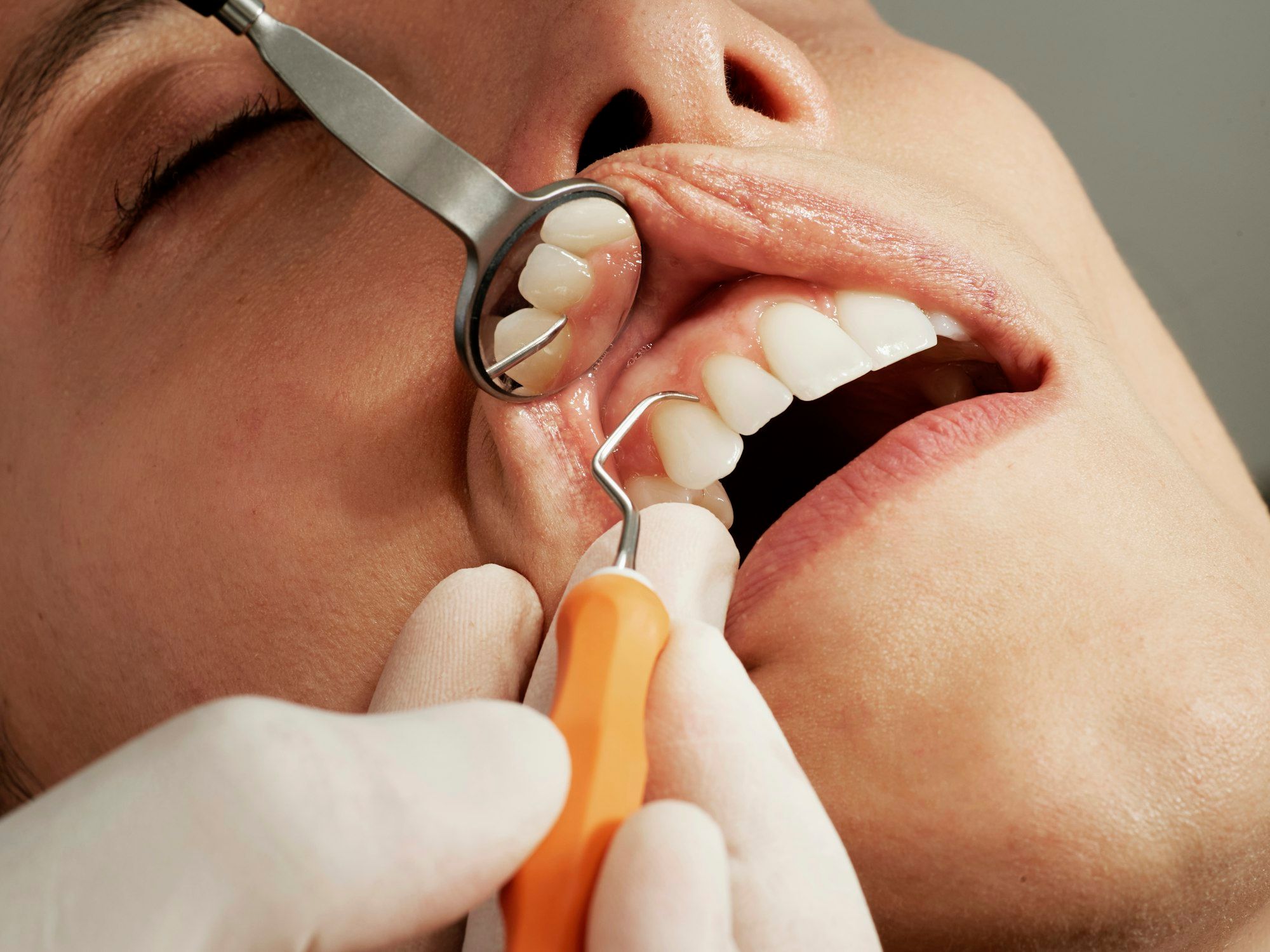 Close-up of a dental checkup: a gloved hand holds a small mirror and a scaler at a patient's teeth